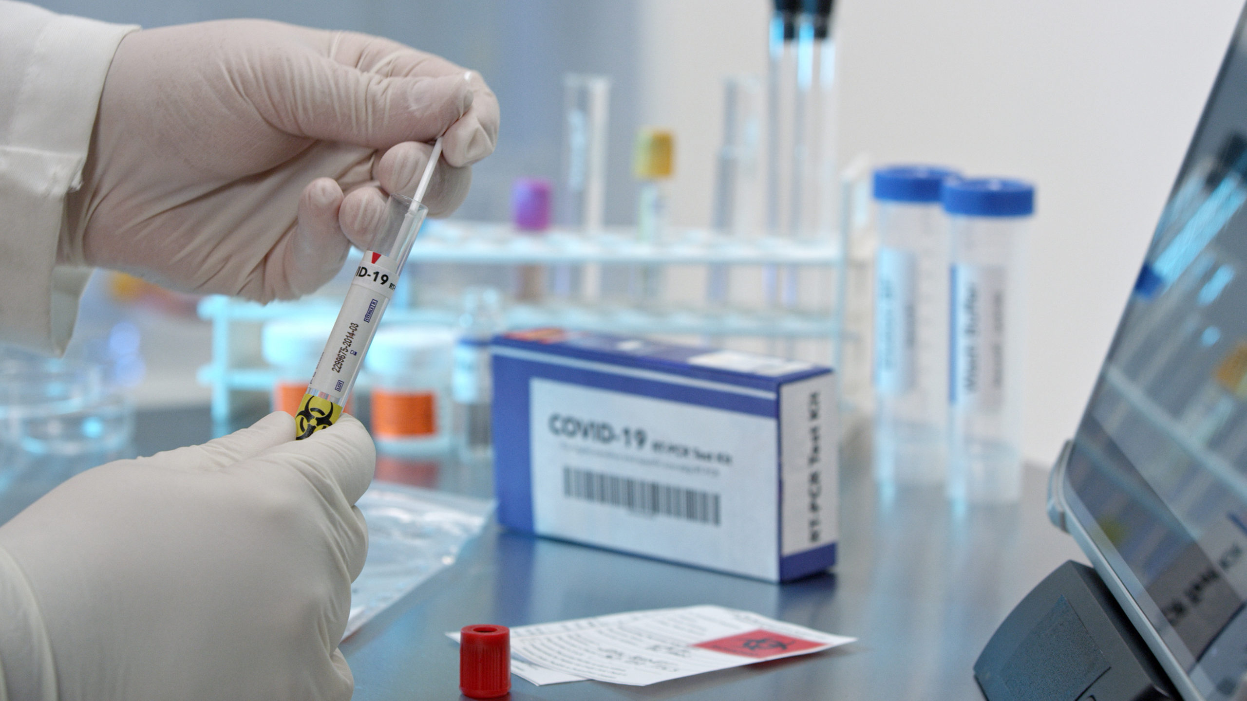 Technician,Adding,Covid-19,Swab,Into,Test,Tub,In,Medical,Lab. PG征途国际官方网站图片